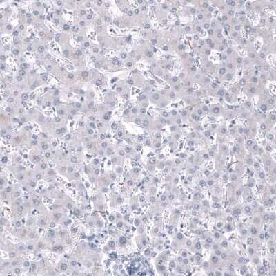 Immunohistochemistry-Paraffin: AlphaB Crystallin/CRYAB Antibody (CL10765) [NBP3-07986]