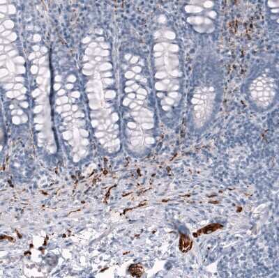 Immunohistochemistry-Paraffin: AlphaB Crystallin/CRYAB Antibody (CL10765) [NBP3-07986]