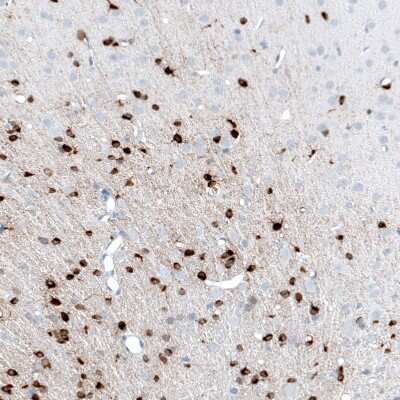 Immunohistochemistry-Paraffin: AlphaB Crystallin/CRYAB Antibody (CL10765) [NBP3-07986]