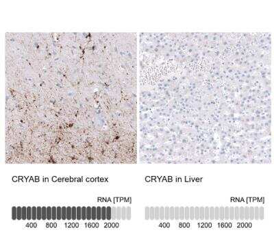 Immunohistochemistry-Paraffin: AlphaB Crystallin/CRYAB Antibody (CL10765) [NBP3-07986]