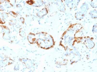 Immunohistochemistry-Paraffin: AlphaB Crystallin/CRYAB Antibody (CPTC-CRYAB-1) - Azide and BSA Free [NBP3-08380]