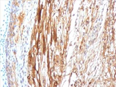 Immunohistochemistry-Paraffin: AlphaB Crystallin/CRYAB Antibody (CPTC-CRYAB-1) - Azide and BSA Free [NBP3-08380]