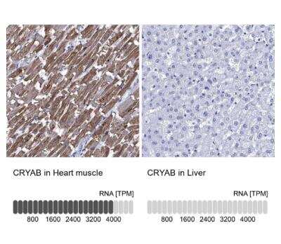 Immunohistochemistry-Paraffin: AlphaB Crystallin/CRYAB Antibody [NBP2-49246]