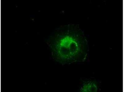 Immunocytochemistry/ Immunofluorescence: AlphaB Crystallin/CRYAB Antibody (OTI6A9) - Azide and BSA Free [NBP2-70454]