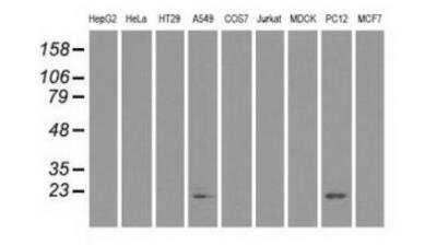 Western Blot: AlphaB Crystallin/CRYAB Antibody (OTI6A9)Azide and BSA Free [NBP2-70454]