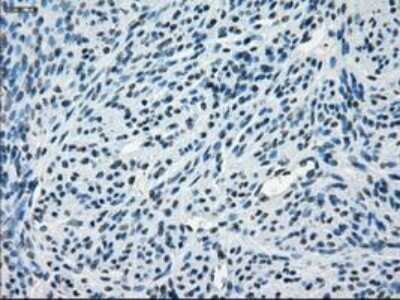 Immunohistochemistry-Paraffin: AlphaB Crystallin/CRYAB Antibody (OTI6A9) [NBP1-47708]