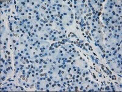 Immunohistochemistry-Paraffin: AlphaB Crystallin/CRYAB Antibody (OTI6A9) [NBP1-47708]
