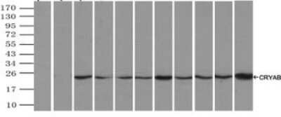 Immunoprecipitation: AlphaB Crystallin/CRYAB Antibody (OTI6A9) [NBP1-47708]