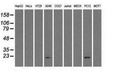 Western Blot: AlphaB Crystallin/CRYAB Antibody (OTI6A9) [NBP1-47708]