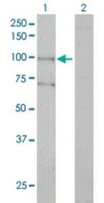 Western Blot: Als2 Antibody (4F9) [H00057679-M01]