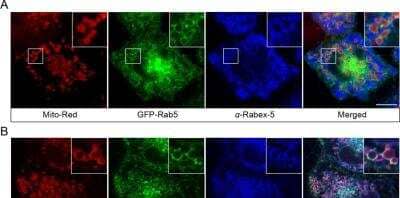 Immunocytochemistry/ Immunofluorescence: Als2 Antibody [NBP2-14284]