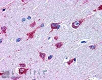 Immunohistochemistry: Als2 Antibody [NB100-885]