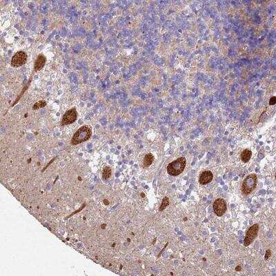 Immunohistochemistry-Paraffin: Als2 Antibody [NBP2-14284]