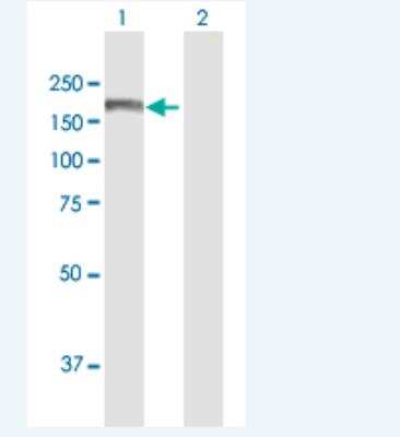 Western Blot: Als2 Antibody [H00057679-B01P-50ug]