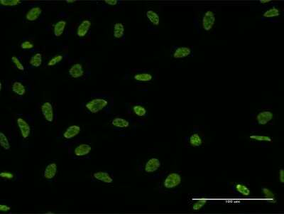 Immunocytochemistry/ Immunofluorescence: Aly Antibody (2G8) [H00010189-M03]