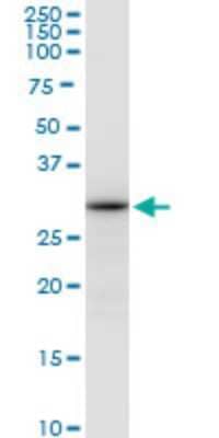 Western Blot: Aly Antibody (2G8) [H00010189-M03]