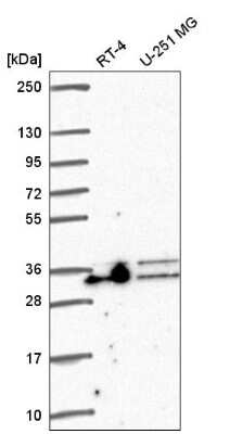 Western Blot: Aly Antibody [NBP2-56154]