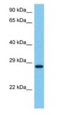 Western Blot: Aly Antibody [NBP3-10855]