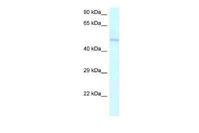 Western Blot: Ameloblastin Antibody [NBP2-88765]