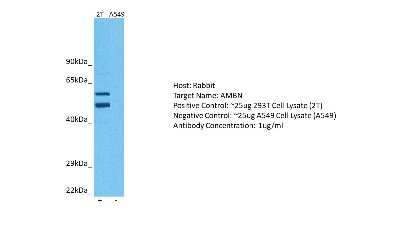 Western Blot: Ameloblastin Antibody [NBP2-88765]