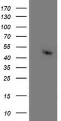Western Blot: Aminoacylase/ACY1 Antibody (OTI1D4) [NBP2-00970]