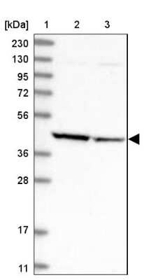 Western Blot: Aminoacylase/ACY1 Antibody [NBP2-14261]