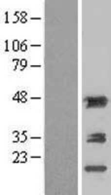 Western Blot: Aminoacylase/ACY1 Overexpression Lysate [NBL1-07300]