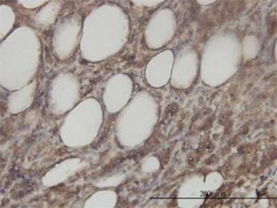 Immunohistochemistry-Paraffin: Aminoacylase/ACY1 Antibody (4F1-B7) [H00000095-M01]