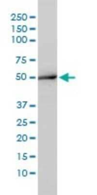 Western Blot: Aminoacylase/ACY1 Antibody (4F1-B7) [H00000095-M01]