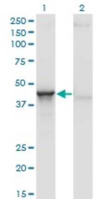 Western Blot: Aminoacylase/ACY1 Antibody (4F1-B7) [H00000095-M01]