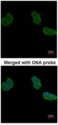 Immunocytochemistry/ Immunofluorescence: Aminoacylase/ACY1 Antibody [NBP1-31366]