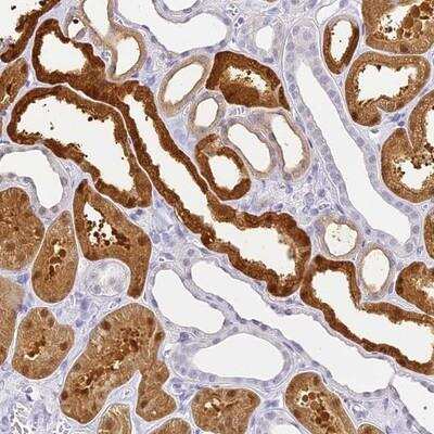 Immunohistochemistry: Aminoacylase/ACY1 Antibody [NBP2-14262]