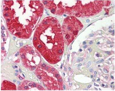 Immunohistochemistry-Paraffin: Aminoacylase/ACY1 Antibody [NBP1-31366]