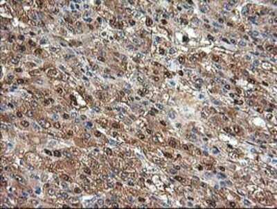 Immunohistochemistry: Aminoacylase/ACY1 Antibody (OTI1D4) - Azide and BSA Free [NBP2-70080]