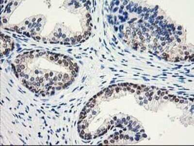Immunohistochemistry: Aminoacylase/ACY1 Antibody (OTI1D4) - Azide and BSA Free [NBP2-70080]