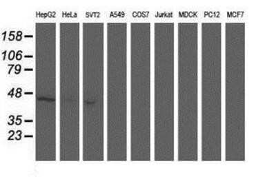 Western Blot: Aminoacylase/ACY1 Antibody (OTI1D4)Azide and BSA Free [NBP2-70080]