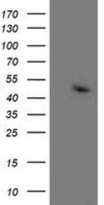 Western Blot: Aminoacylase/ACY1 Antibody (OTI1D4)Azide and BSA Free [NBP2-70080]