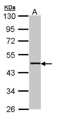 Western Blot: Aminoacylase/ACY1 Antibody [NBP1-31366]