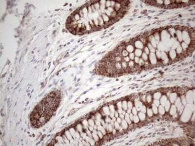 Immunohistochemistry: Aminomethyltransferase Antibody (OTI6F4) [NBP2-46516]
