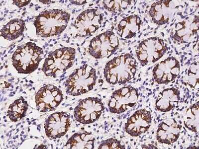 Immunohistochemistry-Paraffin: Aminomethyltransferase Antibody [NBP2-97412]