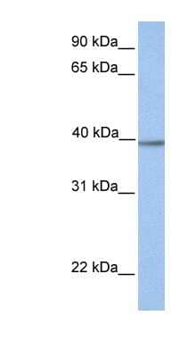 Western Blot: Aminomethyltransferase Antibody [NBP1-54766]