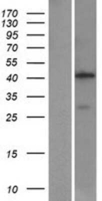 Western Blot: Aminomethyltransferase Overexpression Lysate [NBP2-10675]