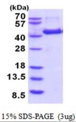 SDS-PAGE: Recombinant Human Aminomethyltransferase His Protein [NBP2-52054]