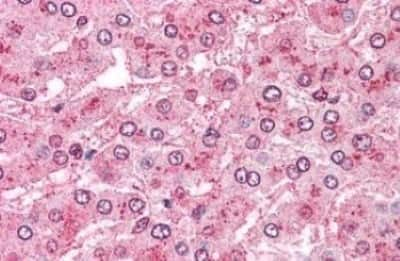 Immunohistochemistry-Paraffin: Aminopeptidase PILS/ARTS1 Antibody [NBP3-14539]