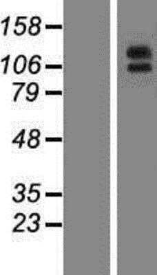 Western Blot: Aminopeptidase A/ENPEP Overexpression Lysate [NBP2-10789]