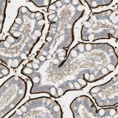 Immunohistochemistry-Paraffin: Aminopeptidase A/ENPEP Antibody [NBP1-85774]