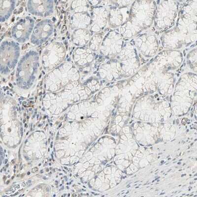 Immunohistochemistry-Paraffin: Aminopeptidase A/ENPEP Antibody [NBP1-85774]