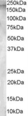 Western Blot: Aminopeptidase A/ENPEP Antibody [NB100-1885]