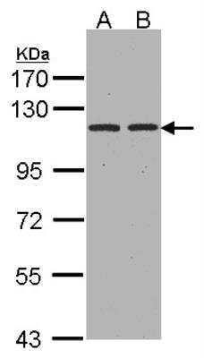 Western Blot: Aminopeptidase A/ENPEP Antibody [NBP1-32442]