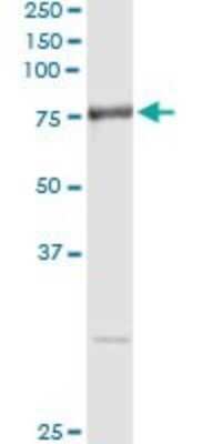 Immunoprecipitation: Aminopeptidase B/RNPEP Antibody (4E1) [H00006051-M02]